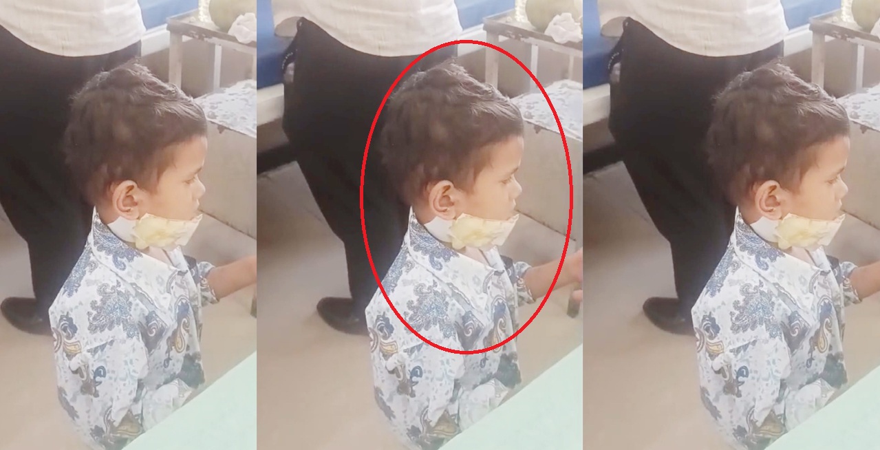 जालना शहरात भटक्या कुत्र्यांचा वाढता उपद्रव; चंदनझीरा येथील चार वर्षीय बालकावर हल्ला